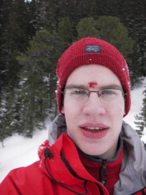 Proste Tilak